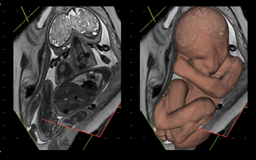 Imagen fetal